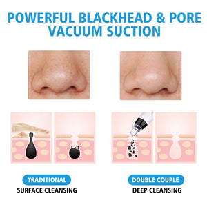 Rose gold Skin Care Pore Vacuum