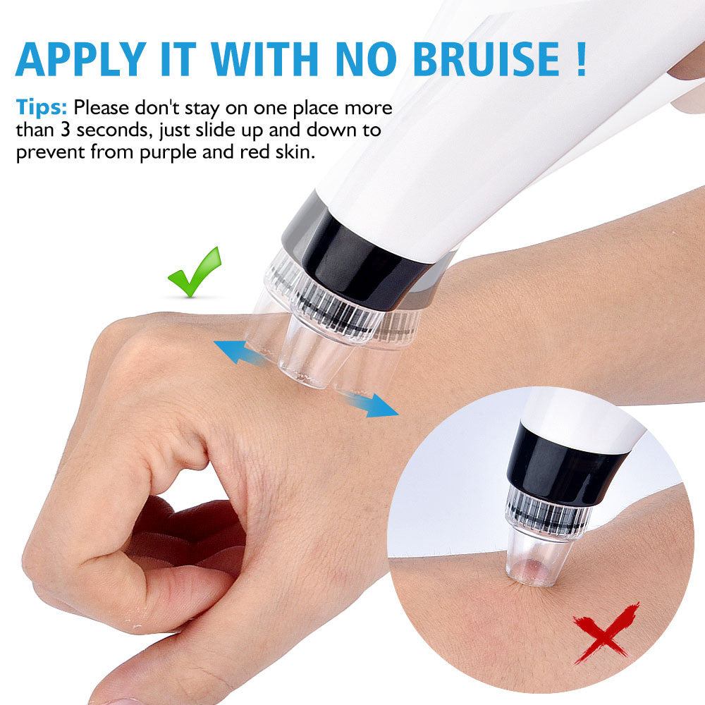 Rose gold Skin Care Pore Vacuum